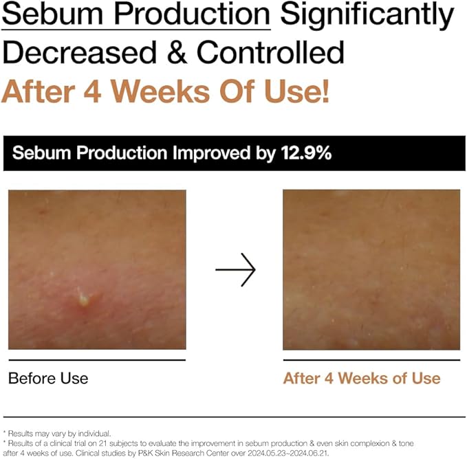 Anua Rice 70+ Glow Milky Toner – Brightening & Hydrating Korean Face Toner (Original)