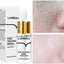 LANBENA - Pore Solution Serum (Original)