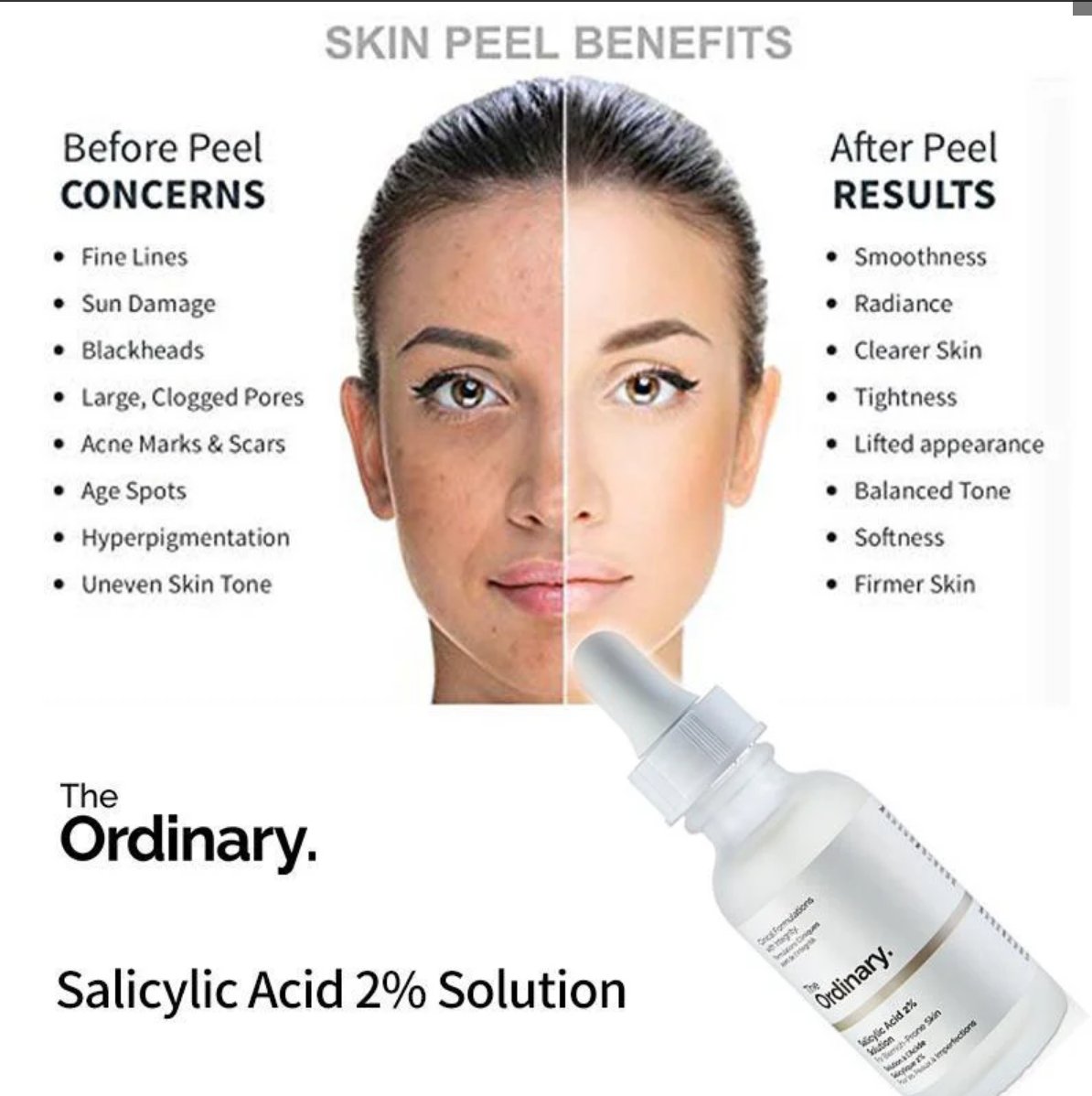The Ordinary Salicylic Acid 2% Solution – Acne & Pore Treatment (Original)