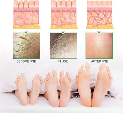 South Moon 42% Urea Cream + 2% Salicylic Acid (Original) – Deep Moisturizing Foot Cream for Cracked Heels | Jasmine Scent | 100g