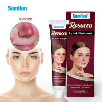 Sumifun - Rosacea Relief Ointment (Original)
